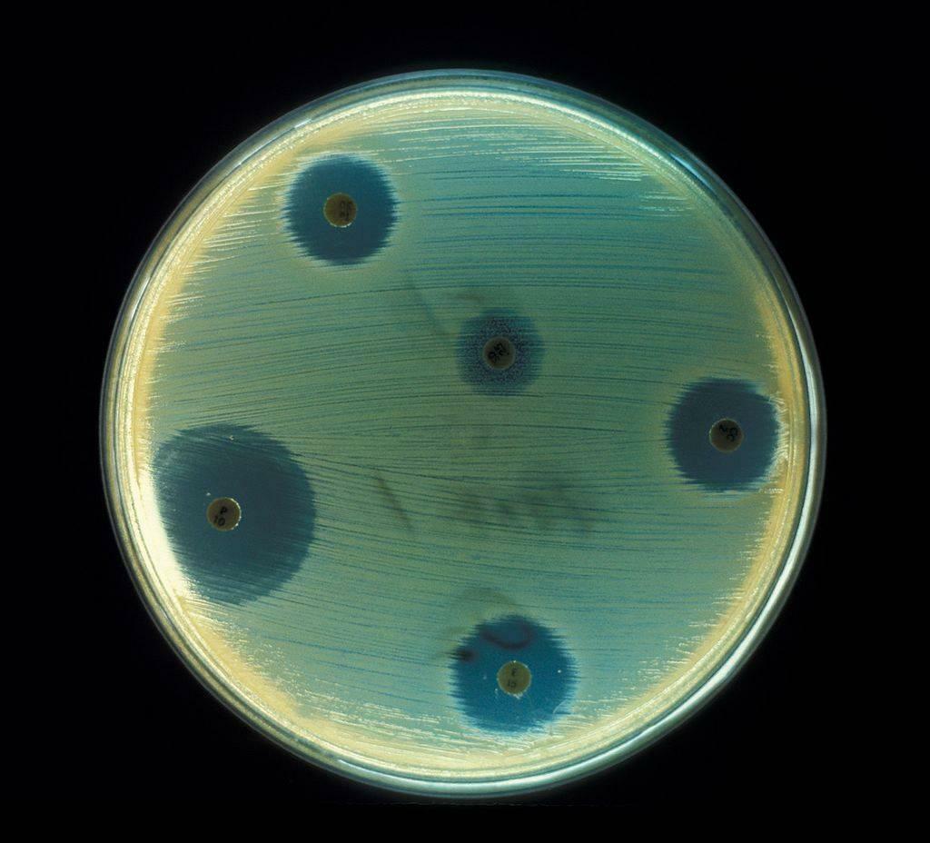 Milloin antibioottiripuli häviää? Mikä on hyvä ripuli antibioottien jälkeen?