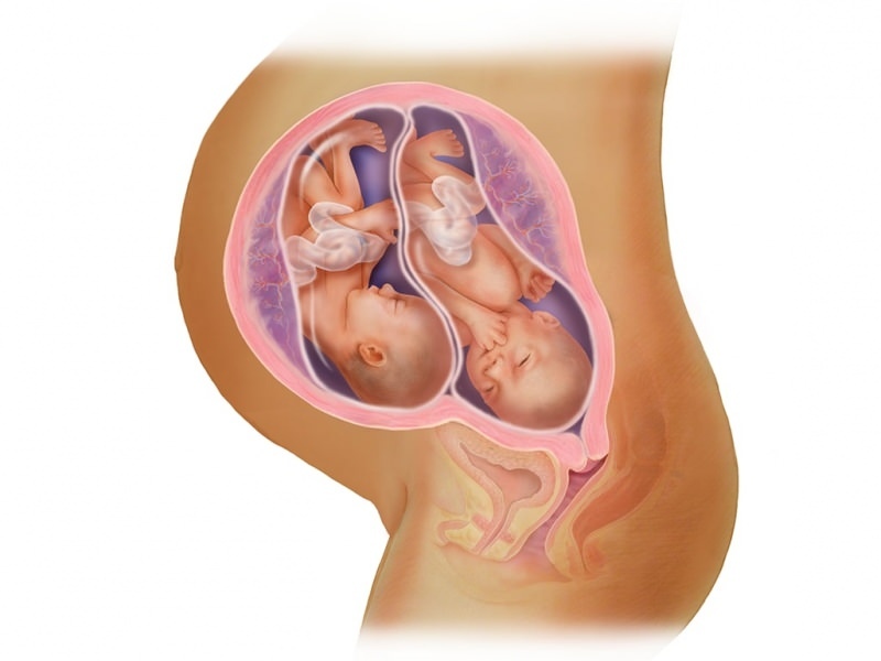 Kaksosraskaus IVF: ssä! Mikä on alkionsiirto?