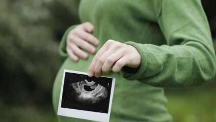 Milloin vauvan sukupuoli on aikaisintaan ja varmaa? Kuka määrittelee sukupuolen?
