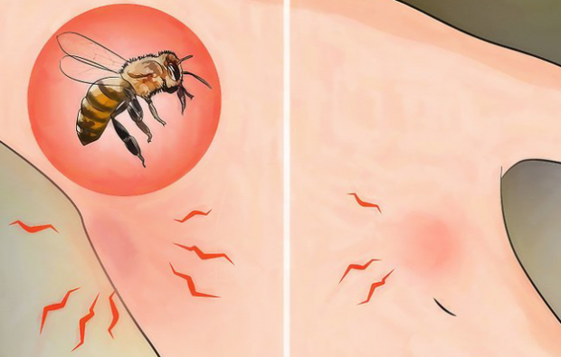 Mikä on mehiläisallergia ja mitkä ovat oireet? Luonnolliset menetelmät, jotka ovat hyviä mehiläispisteille