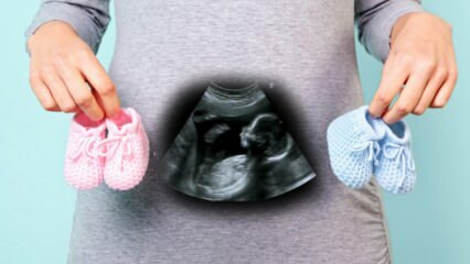 Määritetäänkö vauvan sukupuoli raskauden ensimmäisen kolmanneksen aikana?