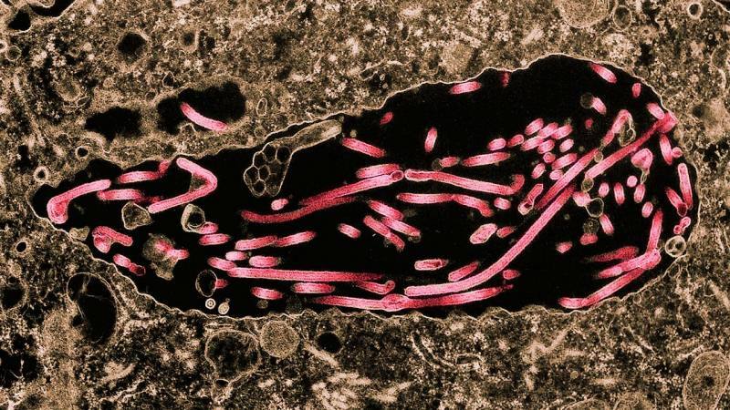 kuva ebolaanista leviämässä soluihin