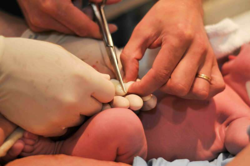 Milloin napanuora tulisi leikata vauvoilla?