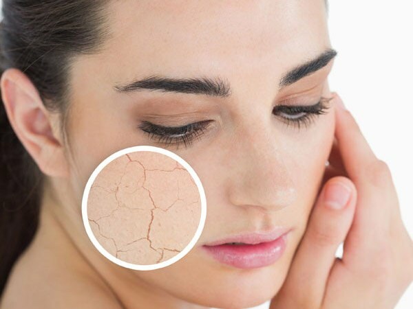 Miksi iho kuivataan? Mitä tehdä kuivalle iholle? Tehokkaimmat hoitosuositukset kuivalle iholle