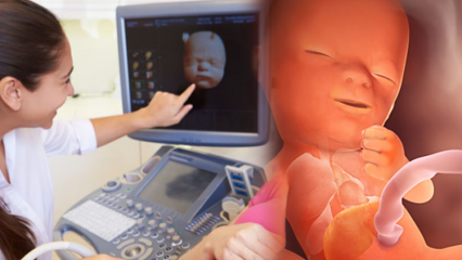 Mikä elin kehittyy ensin vauvoilla? Vauvan kehitys viikoittain