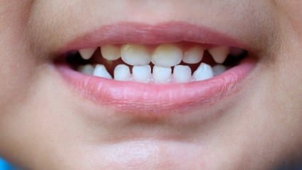 Kuinka opettaa lapsille hammashoitoa?