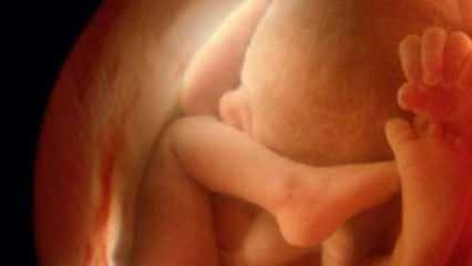 Ei näytä vauvan sukupuolta ultraäänellä! Kuinka poikavauvat ja tytöt näyttävät ultraääneltä?
