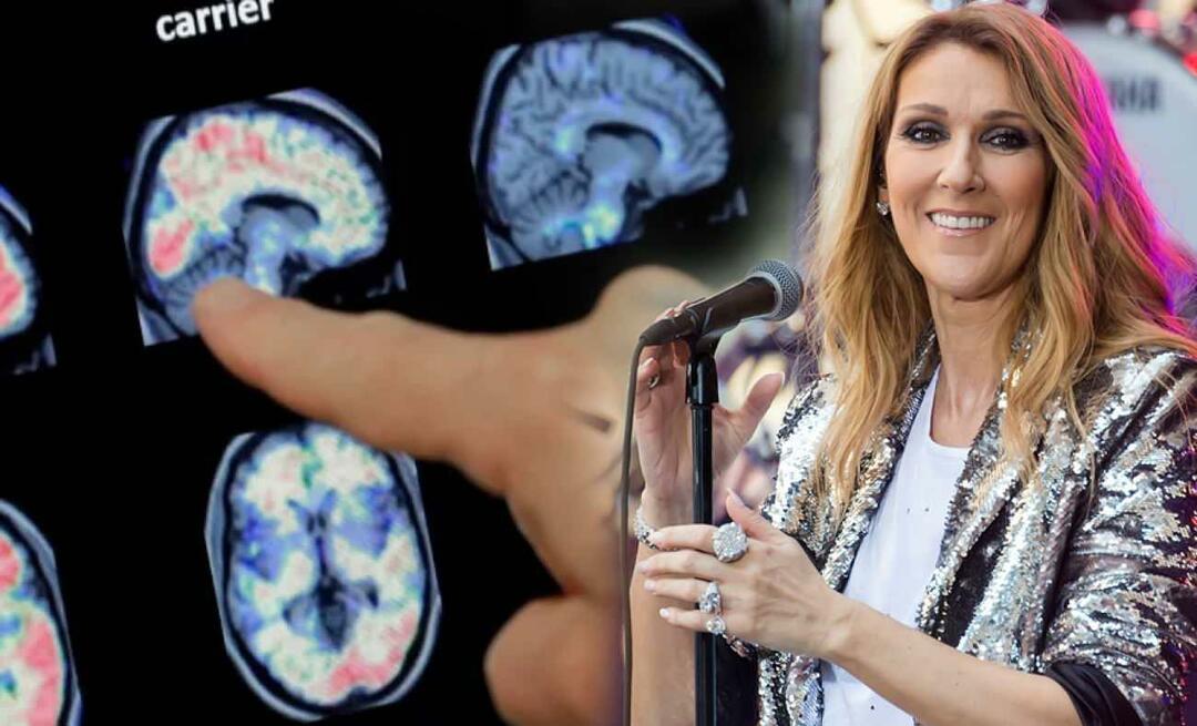 Mikä on jäykän ihmisen oireyhtymä? Mikä on Celine Dionin sairaus?