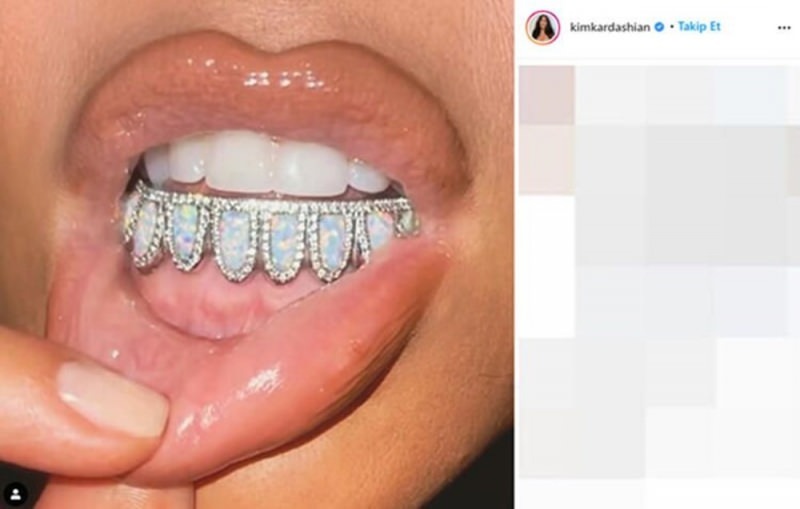 Kim Kardashianin 5000 dollarin hammashelmi