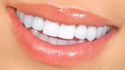 Luonnolliset hampaiden valkaisumenetelmät