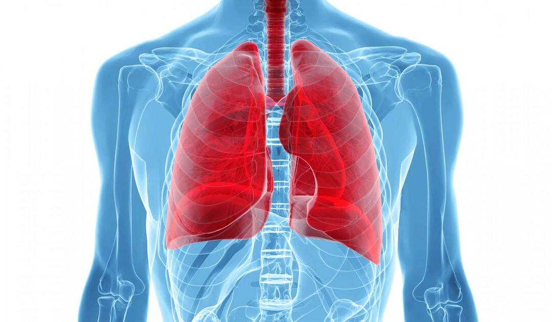 Mikä on valkoinen keuhkosyndrooma ja mitkä ovat sen oireet? Mikä on White Lung Syndroman hoito?
