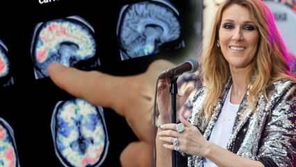 Mikä on jäykän ihmisen oireyhtymä? Celine Dion