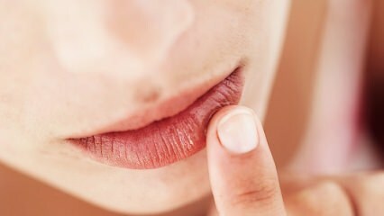 Kuinka huulten hoidon tulisi olla raskauden aikana?