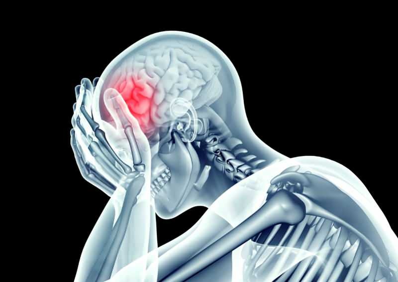 kroonavirus vahingoittaa aivoja kaventamalla suonia