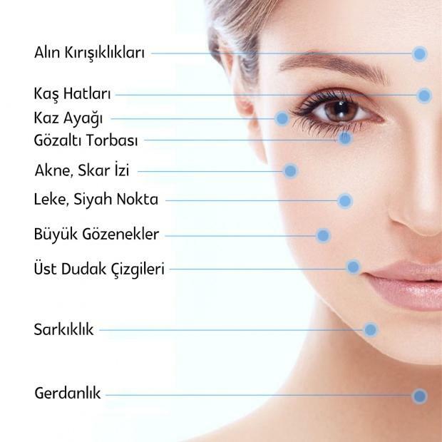 Miten Dermapeniä käytetään? Kuinka monta istuntoa se kestää? Dermapen-sovelluksen hinnat 2022