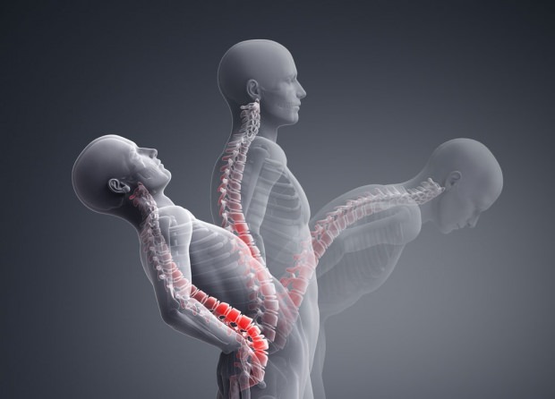 Mikä on selkärangan romahdusmurtuma? Kuinka selkärangan romahdusmurtuman hoito on?