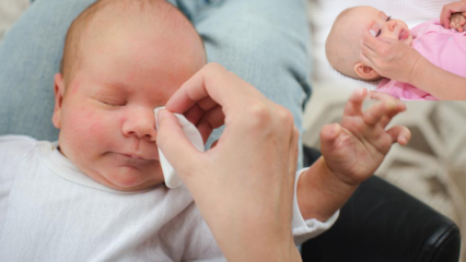 Kuinka poistaa purseet vauvoilla? Aiheuttaa silmien turmeltumista vauvoilla? Burr hieronta äidinmaidolla