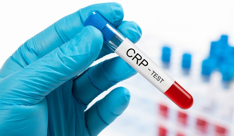 Miksi veren CRP nousee? Mikä on CRP? Kuinka alentaa CRP: tä?