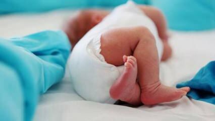 Pitäisikö vauvoilla olla lonkan ultraääni?