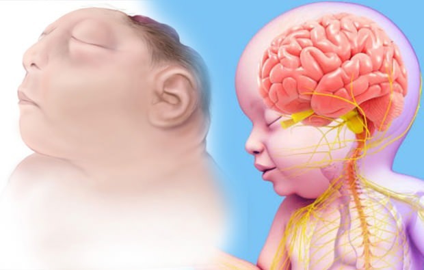Eläkö Anencephaly-vauva? Keuhkosyövän diagnoosi