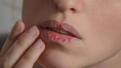 Kuinka hoitaa huulia kotona? Helppo kuivan huulten hoito neljässä vaiheessa