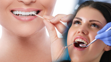 Kuinka suun ja hampaiden terveyttä suojellaan? Mitä asioita tulee ottaa huomioon hampaita puhdistettaessa?