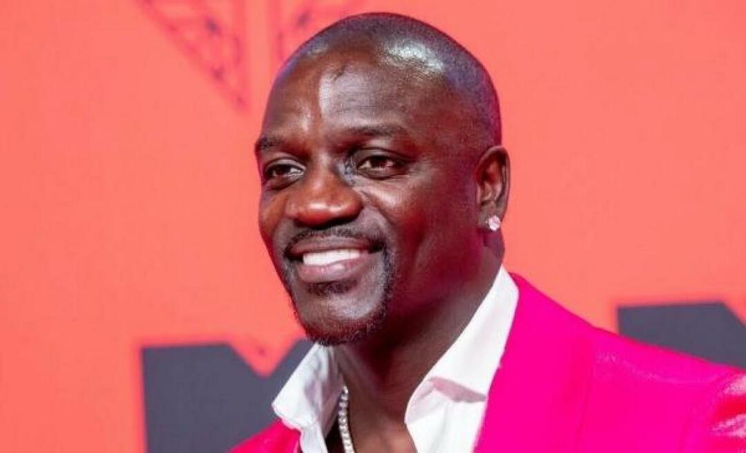 Amerikkalainen laulaja Akon suosi myös Turkkia hiustensiirrossa! Tässä on hänen maksamansa hinta...
