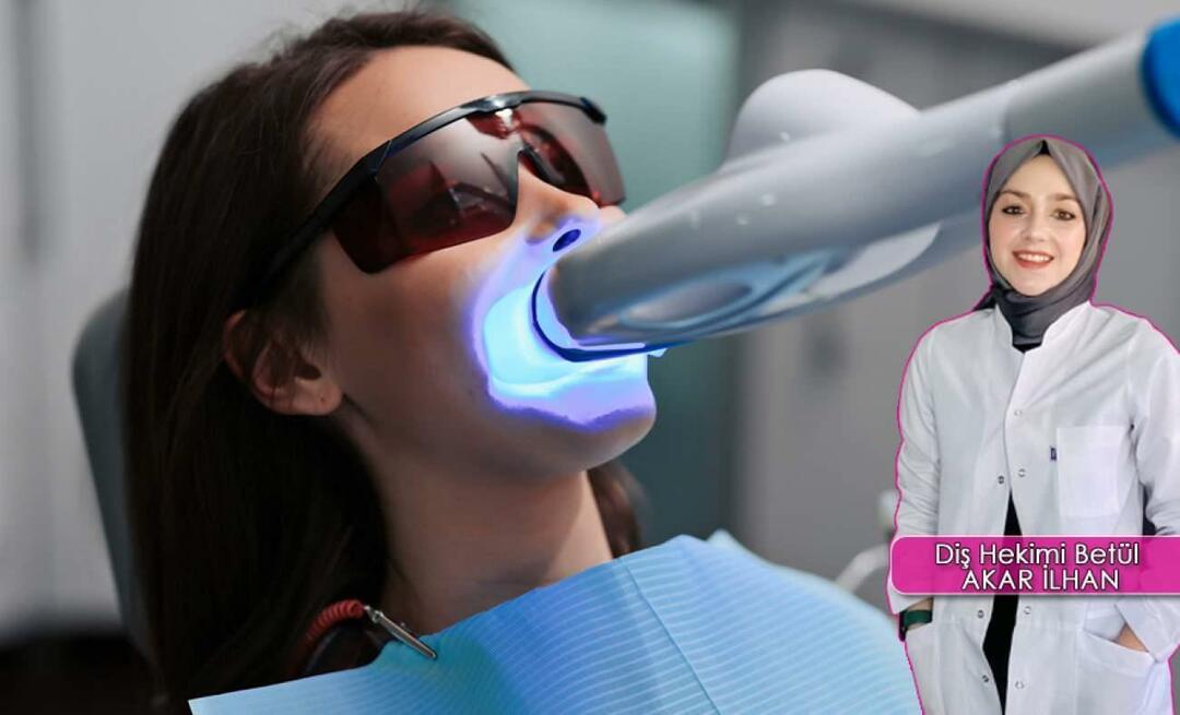Miten hampaiden valkaisumenetelmä (valkaisu) tehdään? Vahingoittaako valkaisumenetelmä hampaita?