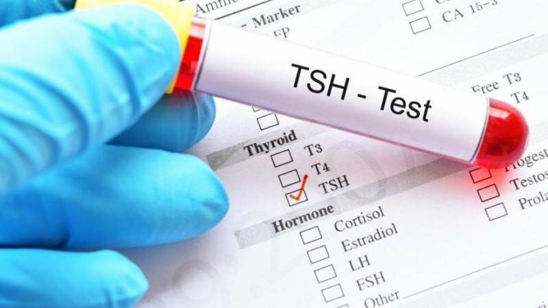 tsh-testi on hormonitesti