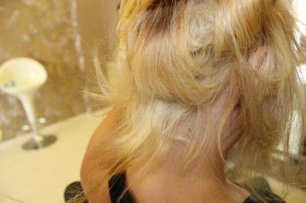 Mitä tehdään polttaville hiuksille keskeltä? Kuinka hoidetut hiukset tulisi ylläpitää?