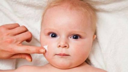 Ihonhoitovinkkejä vauvoille! Mitkä ovat vauvojen iho-ongelmat?