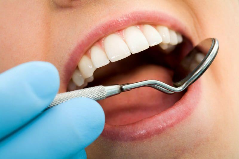 Mikä on hammassärkyhoito? Kuinka hammassärky on?