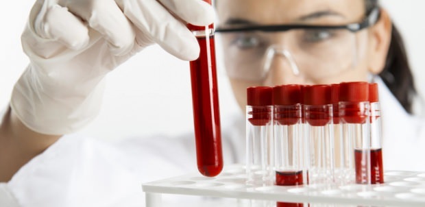 hemoglabiinitaso tarkistetaan verikokeella