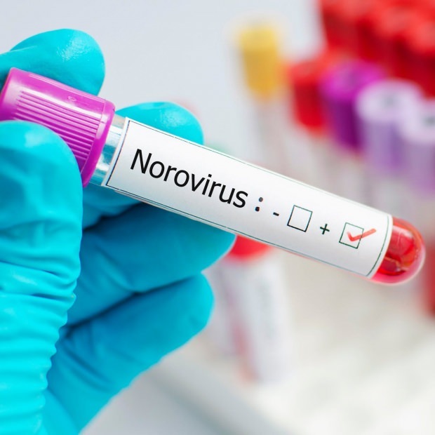 Mikä on norovirus ja mitkä sairaudet aiheuttavat