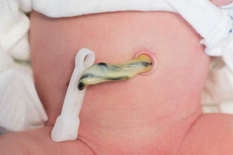 Milloin napanuora putoaa vauvoilla?