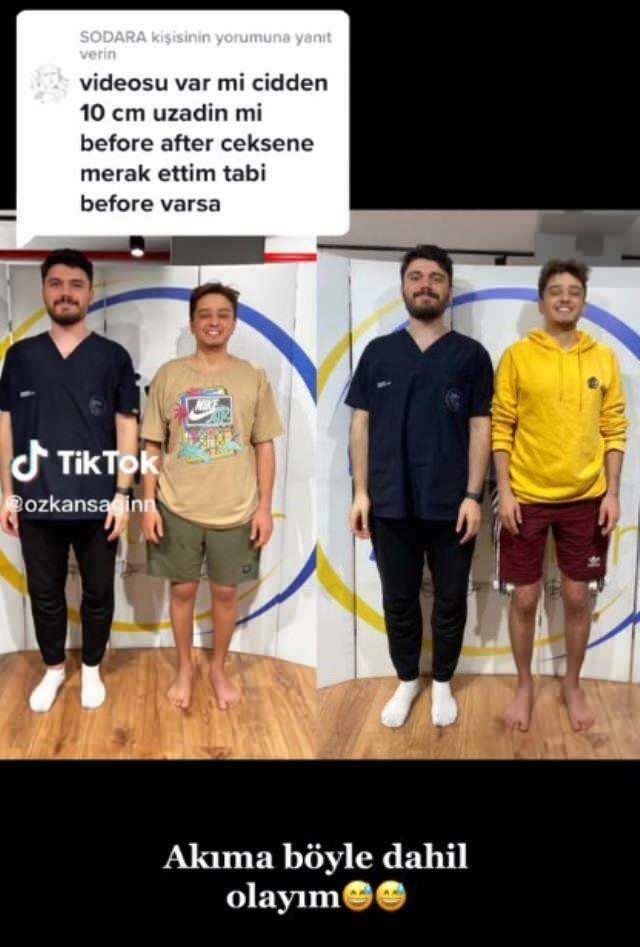 Özkan Sağın teki ennen ja jälkeen leikkauksen