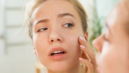Miksi iho kuivataan? Mitä tehdä kuivalle iholle? Tehokkaimmat hoitosuositukset kuivalle iholle