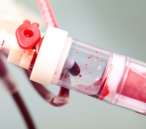 Mikä on alhainen verihiutale (PLT)? Mitkä ovat verihiutaleiden puutoksen oireet?