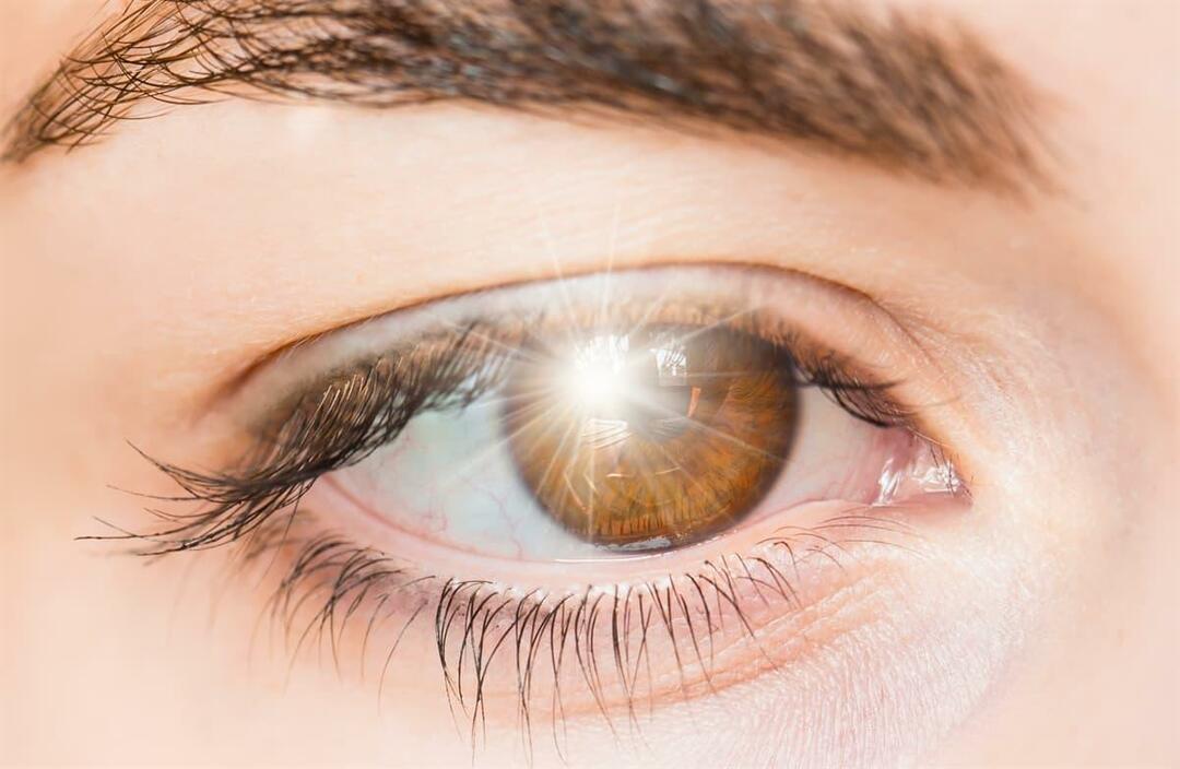 Mikä aiheuttaa valon välähdyksiä silmässä ja miten sitä hoidetaan?