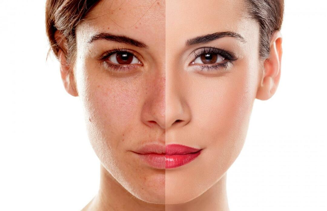 Miten estämme ihoa näyttämästä väsyneeltä? Miten vähentää väsyneen ihon ulkonäköä?