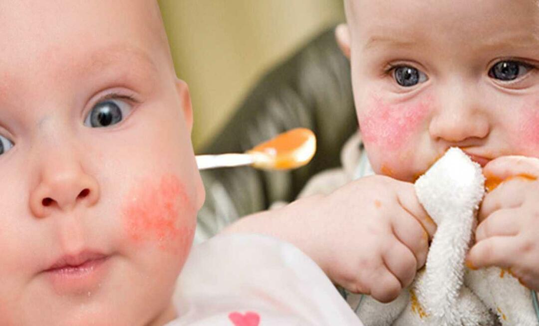Mitä allergisen vauvan pitäisi syödä? Mitä vaihtoehtoisia ruokia on allergisille vauvoille?