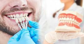 Miksi zirkoniumviilua levitetään hampaille? Kuinka kestävä zirkoniumpinnoite on?