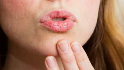 Kuinka tehdä huultenhoitoa kotona? Helppo kuivien huulten hoito 4 vaiheessa