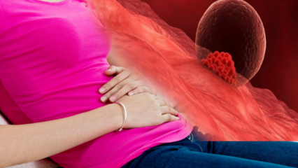 Mikä on implantin verenvuoto raskauden aikana? Kuinka erottaa implantointivuoto kuukautisvuodosta